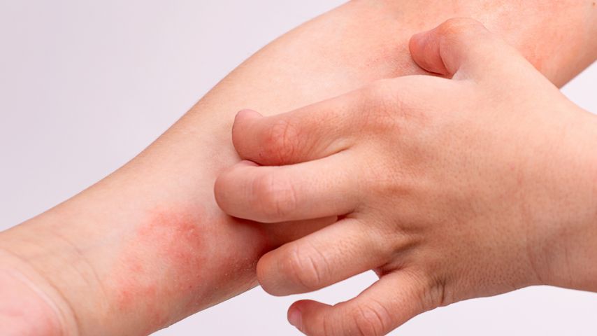 6. díl: Co na rozpraskané, bolavé a suché ruce v zimě? Inspirujte se našimi tipy